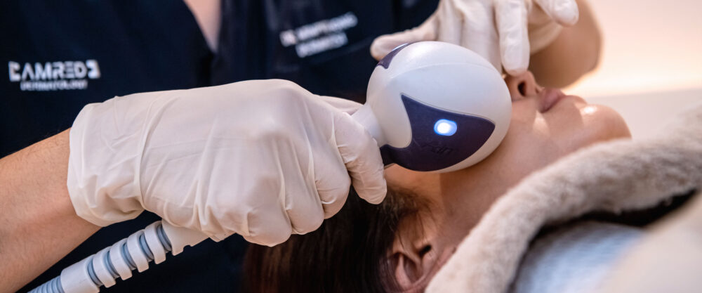 チューンフェイス